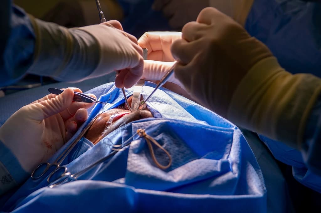Glaucoma Shunt / Tube Surgery